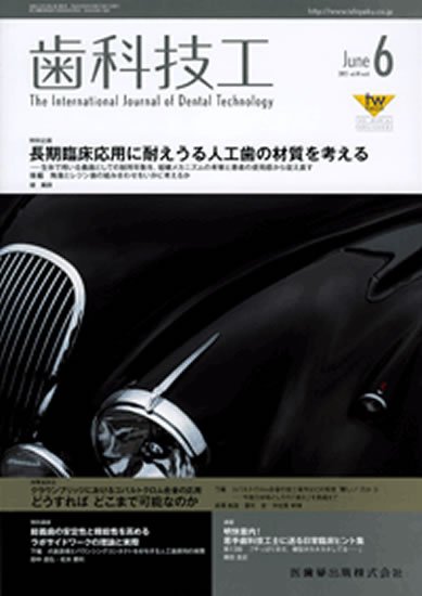 歯科技工 41巻6号 (発売日2013年05月25日) 表紙