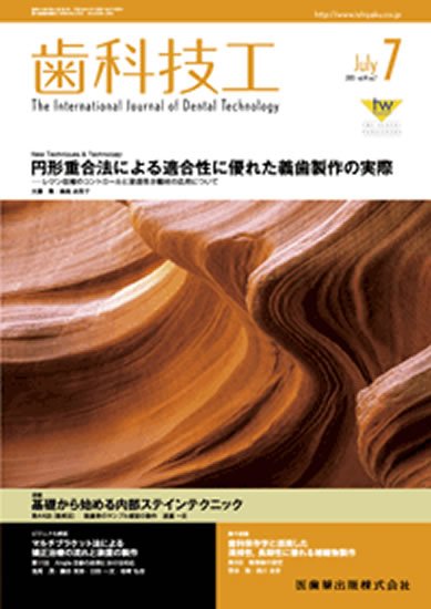 歯科技工 41巻7号 (発売日2013年06月25日) 表紙