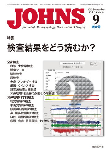 JOHNS（ジョウンズ） 13年9月増大号 (発売日2013年09月01日) 表紙