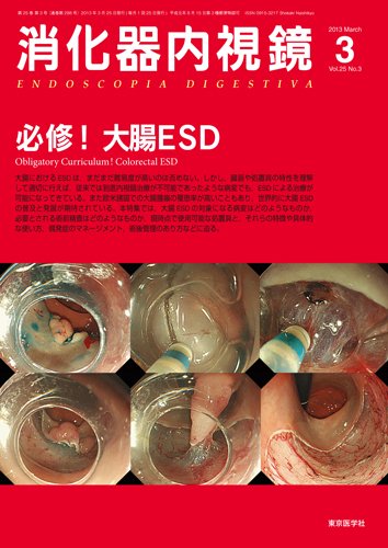 消化器内視鏡 13年3月号 (発売日2013年03月25日) 表紙