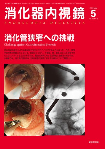 消化器内視鏡 13年5月号 (発売日2013年05月25日) 表紙
