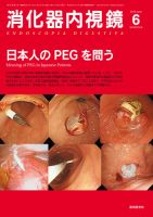 消化器内視鏡 13年6月号 表紙