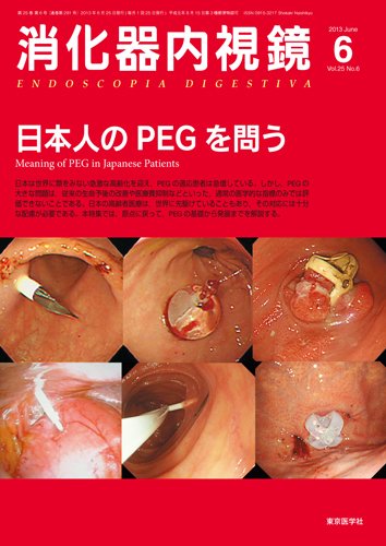 消化器内視鏡 13年6月号 (発売日2013年06月25日) 表紙