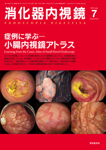消化器内視鏡 13年7月号 (発売日2013年07月25日) | 雑誌/定期購読の予約はFujisan