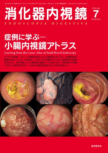 消化器内視鏡 13年7月号 (発売日2013年07月25日) | 雑誌/定期購読の