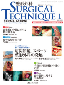 小児整形外科手術テクニック 小児整形外科手術テクニック : 日本小児整形外科学会 | HMV&BOOKS