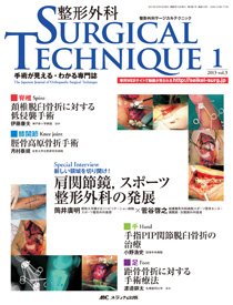 整形外科サージカルテクニック 2013年1号 (発売日2013年01月15日) 表紙