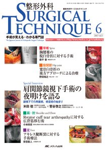 整形外科サージカルテクニック 2013年6号 (発売日2013年11月15日) 表紙