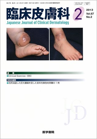 臨床皮膚科 Vol.67 No.2 (発売日2013年02月01日) | 雑誌/定期購読の