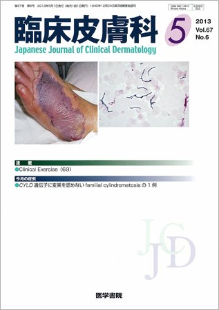 臨床皮膚科 Vol.67 No.6 (発売日2013年05月01日) | 雑誌/定期購読の