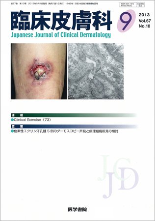 臨床皮膚科 Vol.67 No.10 (発売日2013年09月01日) 表紙