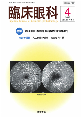 臨床眼科 Vol.67 No.4 (発売日2013年04月15日) | 雑誌/定期購読の予約