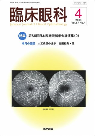 臨床眼科 Vol.67 No.4 (発売日2013年04月15日) 表紙