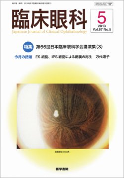 優待特典一覧 No.5 Vol.67 臨床眼科 (発売日2013年05月15日) 雑誌/定期購読 | 臨床医学