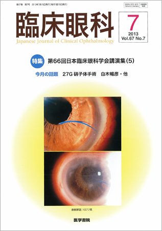 臨床眼科 Vol.67 No.7 (発売日2013年07月15日) 表紙