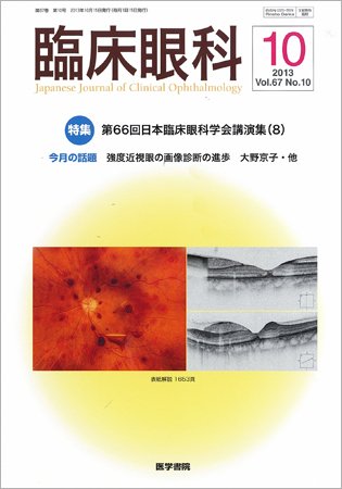 臨床眼科 Vol.67 No.10 (発売日2013年10月15日) 表紙