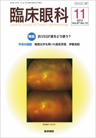臨床眼科 Vol.67 No.11 (発売日2013年10月30日) 表紙