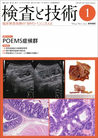 検査と技術 Vol.41 No.1 (発売日2013年01月01日) 表紙