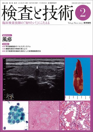 検査と技術 Vol.41 No.2 (発売日2013年02月01日) 表紙