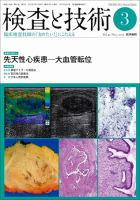検査と技術 Vol.41 No.3 表紙