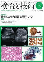 検査と技術 Vol.41 No.5 表紙