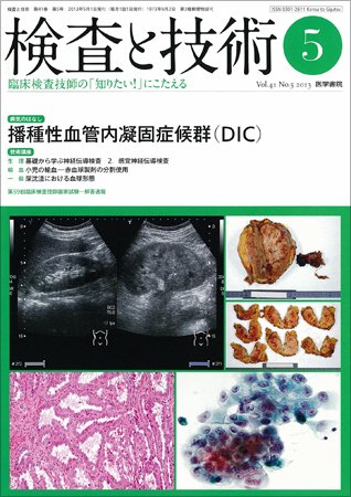 検査と技術 Vol.41 No.5 (発売日2013年05月01日) 表紙