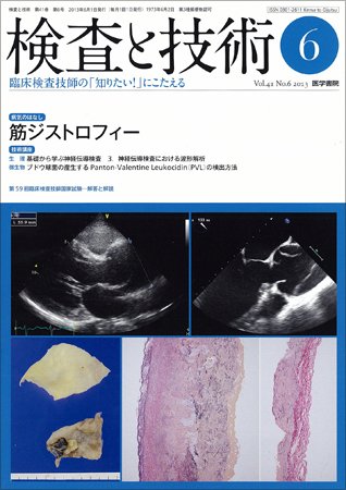 検査と技術 Vol.41 No.6 (発売日2013年06月01日) 表紙