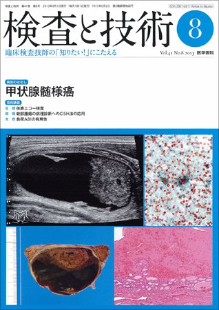 検査と技術 Vol.41 No.8 (発売日2013年08月01日) 表紙