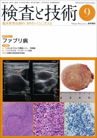 検査と技術 Vol.41 No.9 (発売日2013年09月01日) 表紙