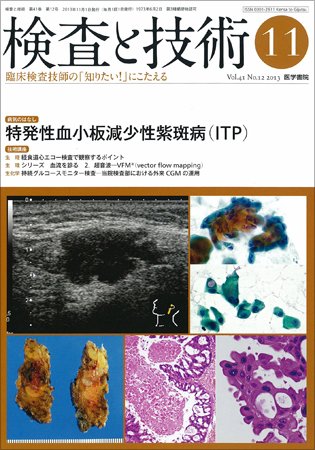 検査と技術 Vol.41 No.12 (発売日2013年11月01日) 表紙