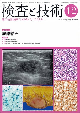 検査と技術 Vol.41 No.13 (発売日2013年12月01日) 表紙