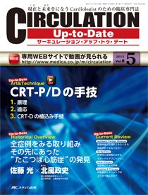 CIRCULATION Up-to-Date（サーキュレーション・アップ・トゥ・デート） 2013年5号 (発売日2013年09月27日) 表紙