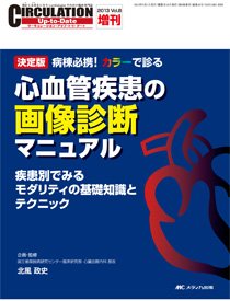 CIRCULATION Up-to-Date（サーキュレーション・アップ・トゥ・デート） 増刊号 (発売日2013年02月15日) 表紙
