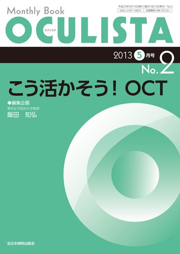 OCULISTA（オクリスタ） 5月号 (発売日2013年05月15日) 表紙