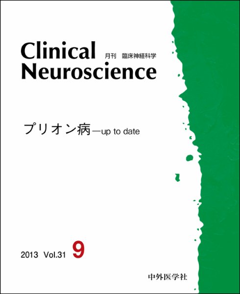 Clinical Neuroscience（クリニカルニューロサイエンス） 2013年9月号 (発売日2013年09月01日) 表紙